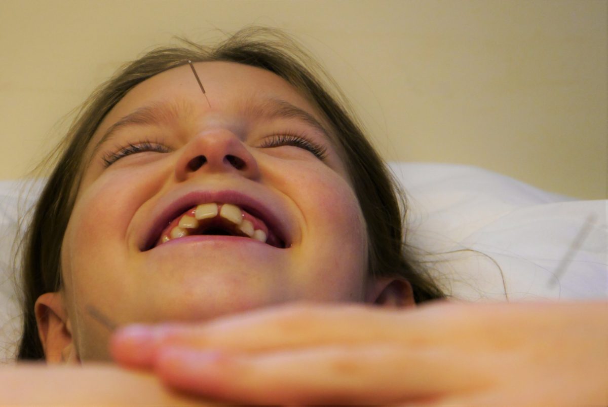 Lachend kind tijdens een acupunctuurbehandeling